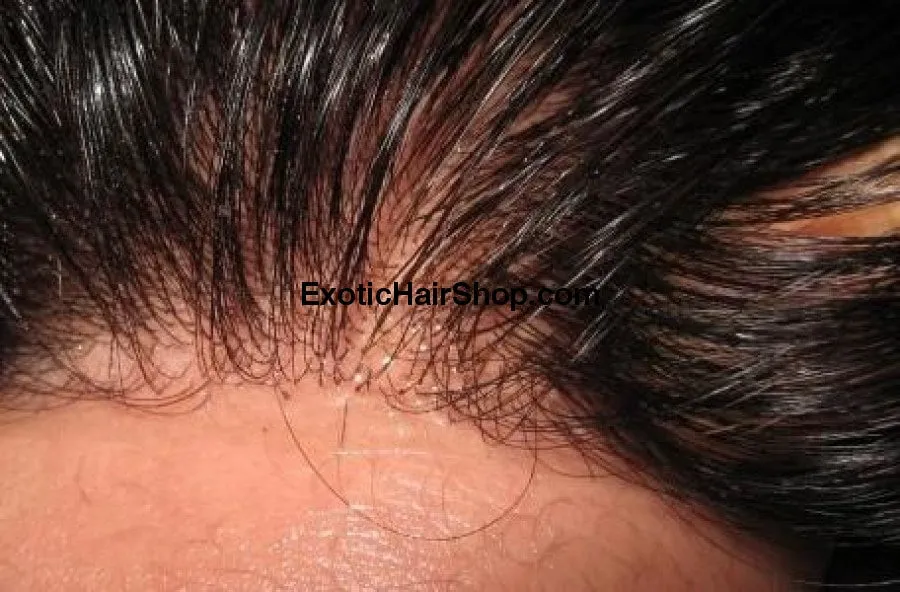 HD Thin Lace Closure - 5x5